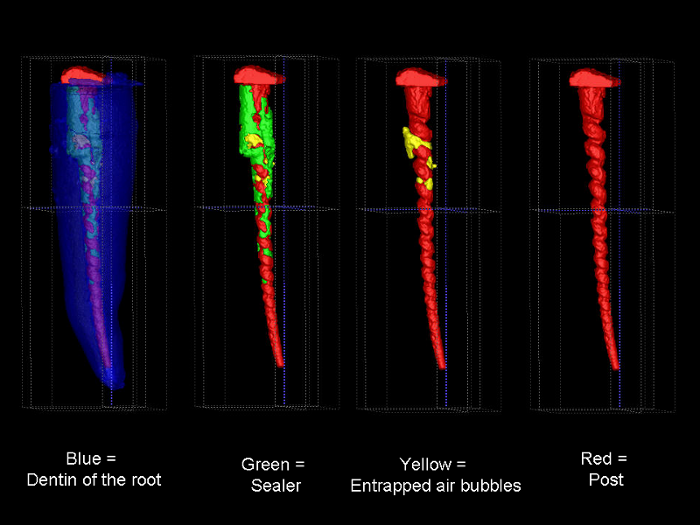 MicroCT Endo