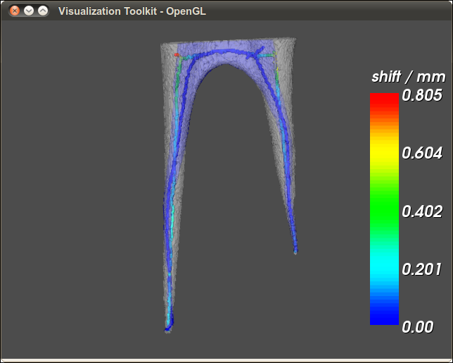 endo-canal-before-and-after-treatment