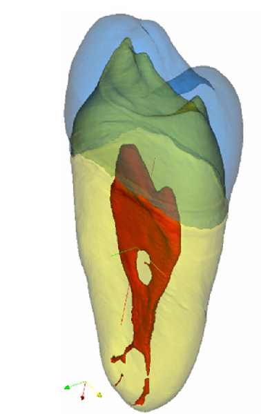 MicroCT Segmentierter Zahn