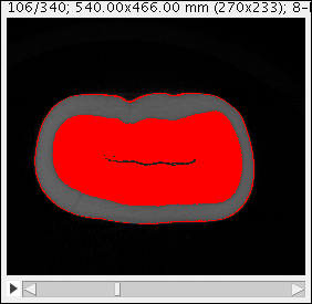 Fig. 11